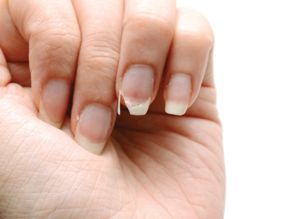 1200-540220132-female-hand-broken-nail