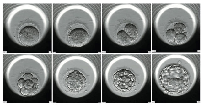 embryoscope