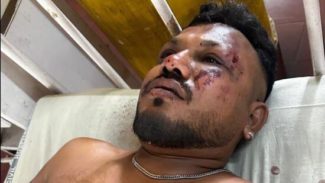 ವಿಮಾನ ದುರಂತದಲ್ಲಿ ಒಬ್ಬ ಬದುಕಿದ್ದೇ ಪವಾಡ..!