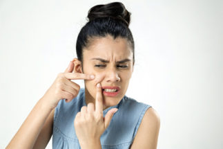 ಆ್ಯಕ್ನೆ ಸ್ಕಾರ್ಸ್‌ ಇದರ ನಿವಾರಣೆ ಹೇಗೆ?