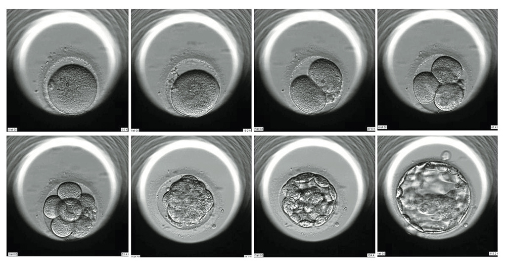 embryoscope
